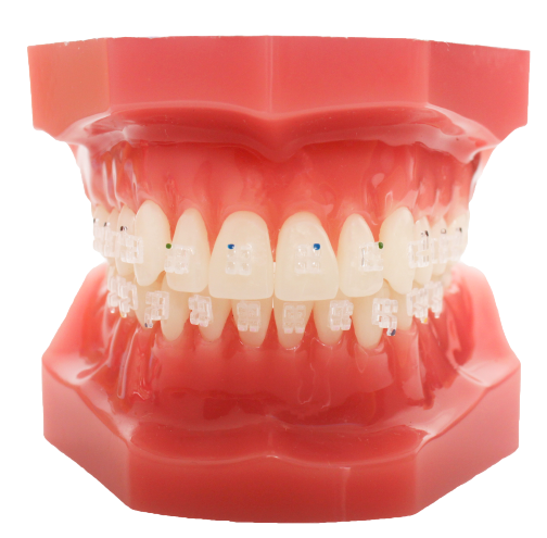 HYPE™ HYBRID-RESIN BRAKET 
