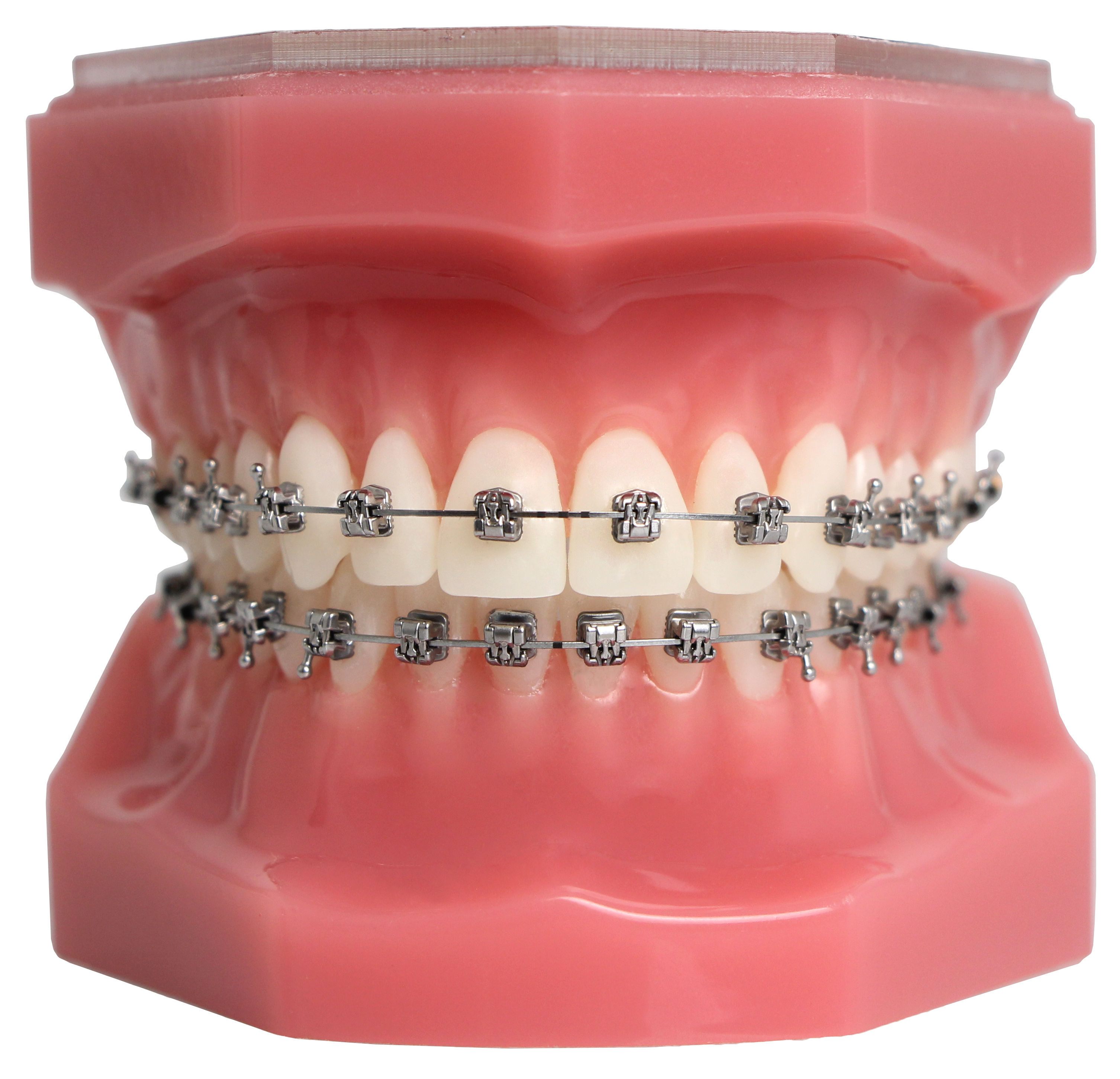 H4 SELF LIGATION BRAKET SİSTEMİ