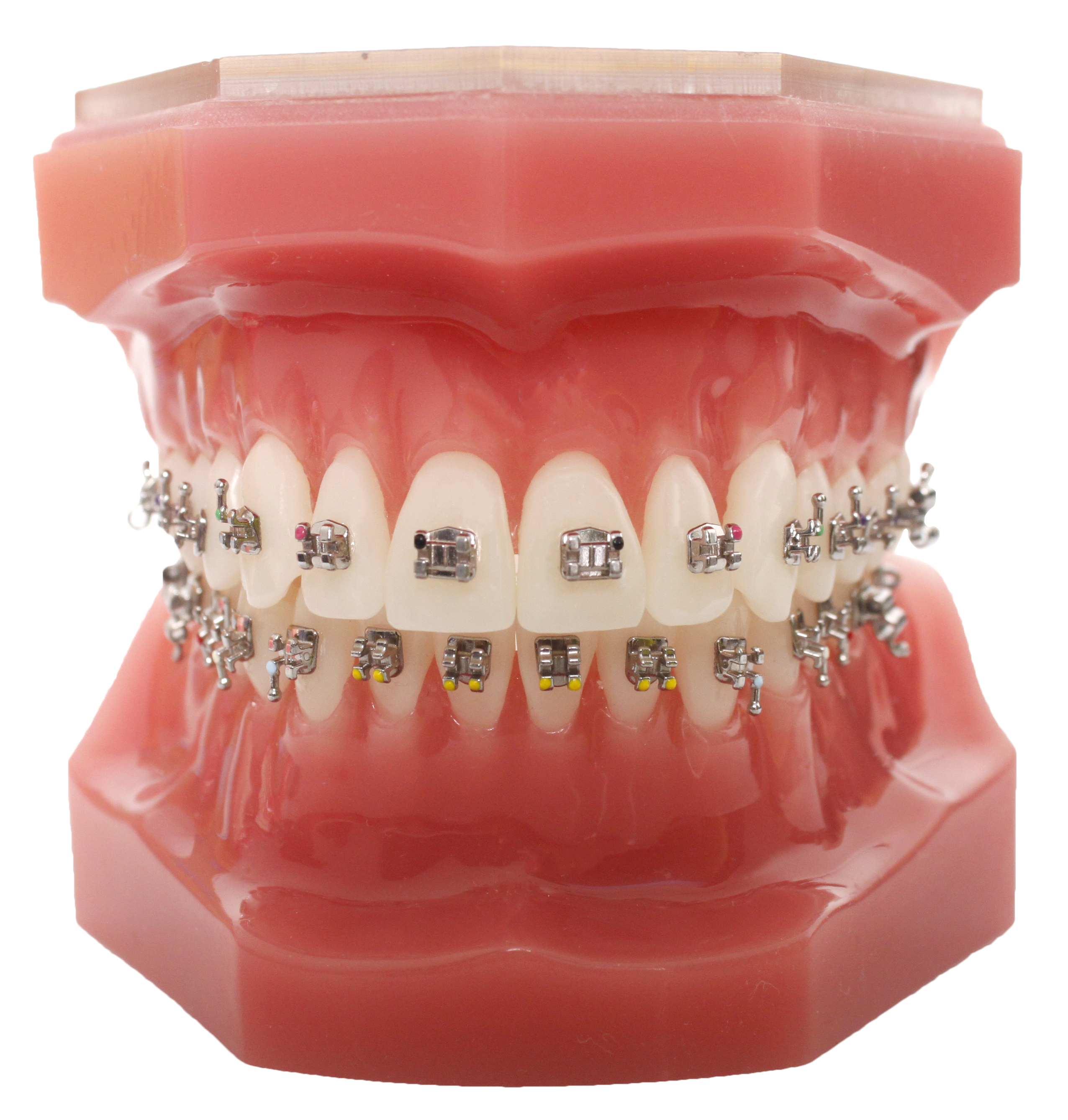 BioMIM® MINI-TWIN METAL BRAKET